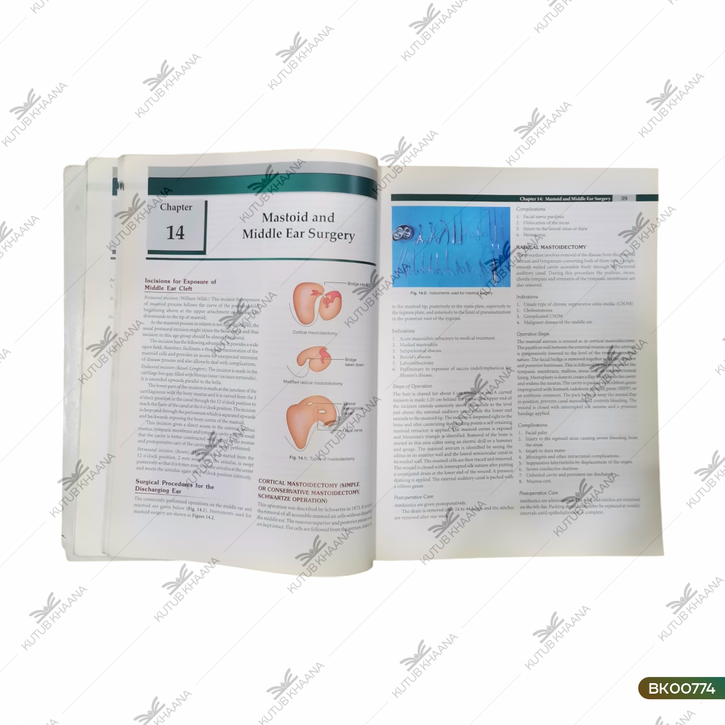 Textbook of Ear, Nose & Throat Diseases